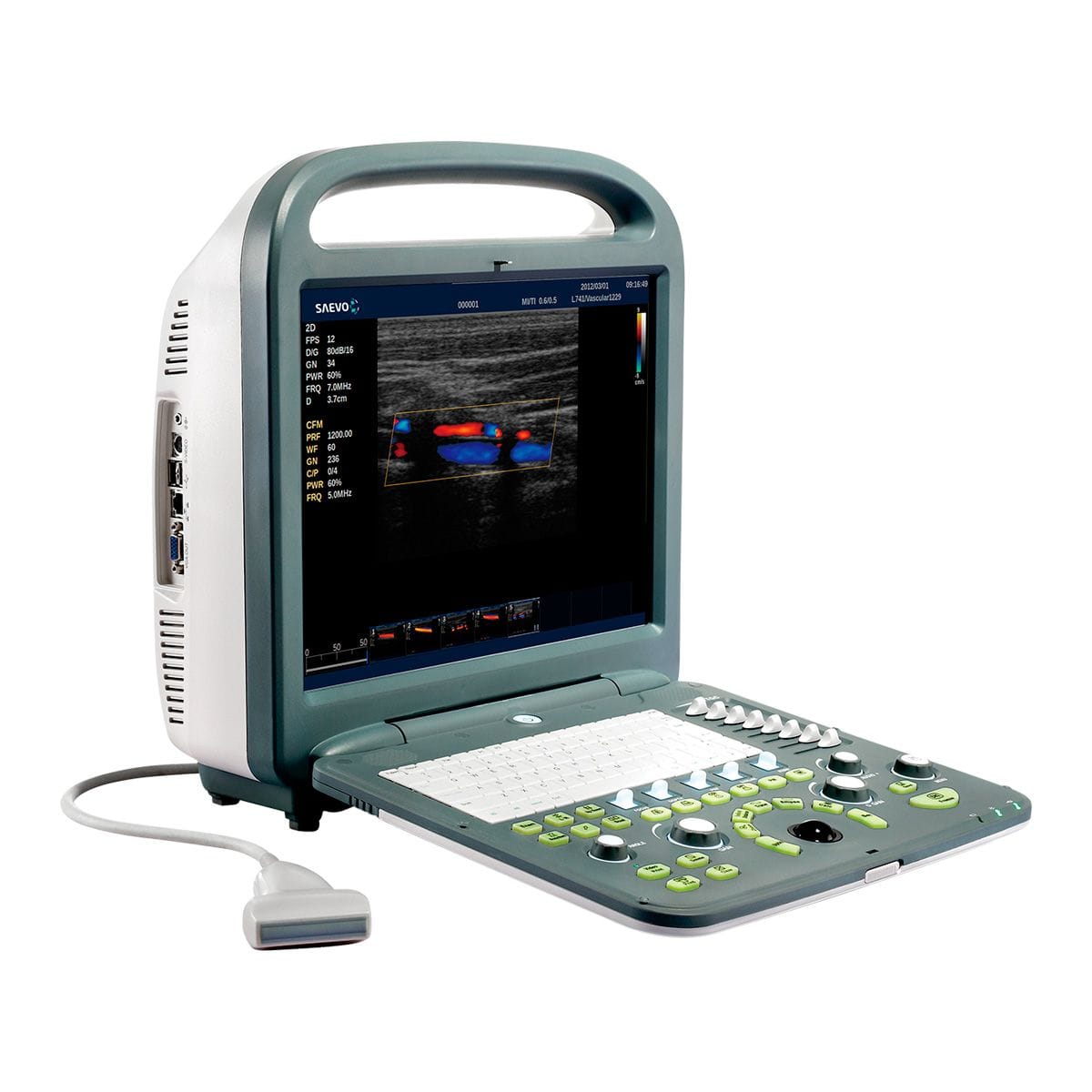 Read more about the article Eco Cardiógrafos